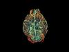 أحد بروتينات الدماغ قد يكون السبيل للوقاية من الزهايمر