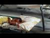 منظمة الصحة العالمية تعلن عن إصابة 11 حالة بالكوليرا في صنعاء