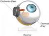 عين اصطناعية تمنح كفيفي البصر أملا جديدا 