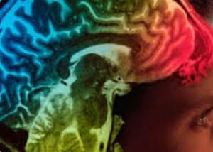  اكتشاف جديد قد يساعد على إبطال تلف الدماغ