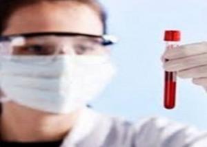 علماء أمريكيون : تحديد البروتين المسئول عن تعفن الدم