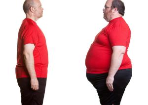 أخصائي سمنة ونحافة يؤكد ان جراحات السمنة لا تقضى على زيادة الوزن