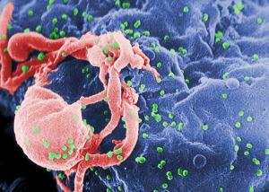 علماء يكتشفون جسماً مضاداً يثبّط مفعول 98% من سلالات الإيدز