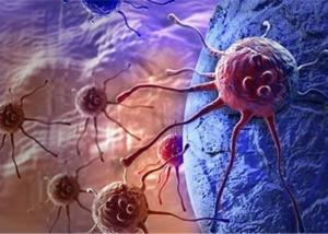 الزمن والساعة والدورة البيولوجية عوامل تساعد فى العلاج الفعال لمريض السرطان