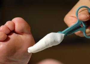 استخدام جزيئات الفضة النانومترية على جوارب مرضى السكري